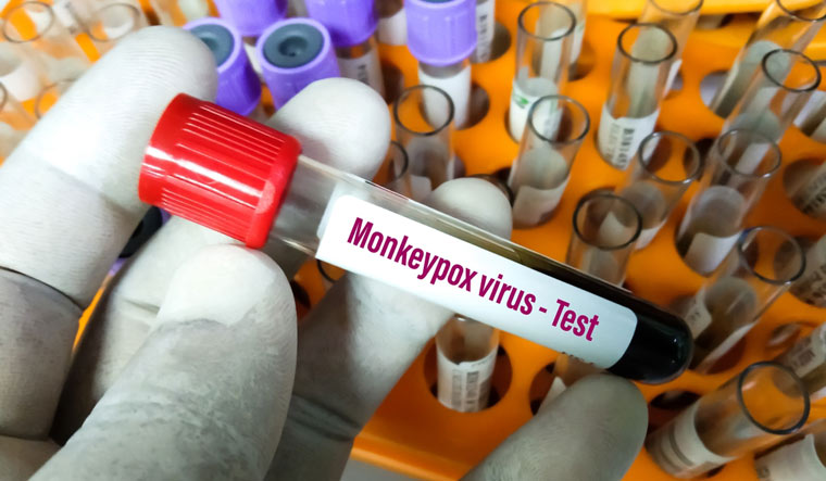 Kerala should give importance to virology research, says NITI Aayog - Vimarsana News