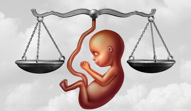 'Unborn child's rights can't be ignored': SC on woman's plea to abort 26-week pregnancy - Vimarsana News