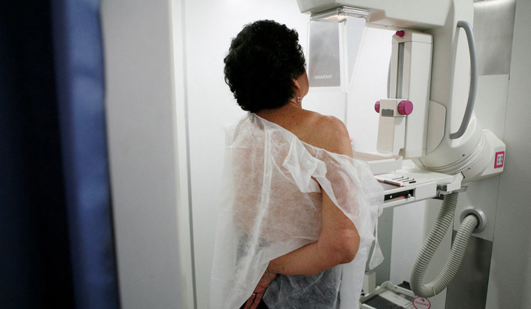 Novel antibody may offer effective drug treatment for breast cancer: Study - Vimarsana News