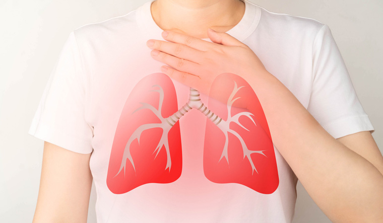 Why have efforts to eradicate TB been so slow - Vimarsana News
