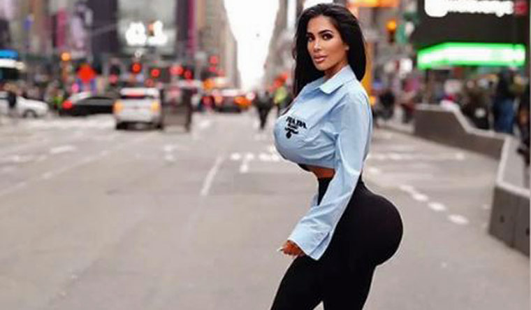 Kim Kardashian lookalike dies of cardiac arrest, hours after plastic surgery - Vimarsana News