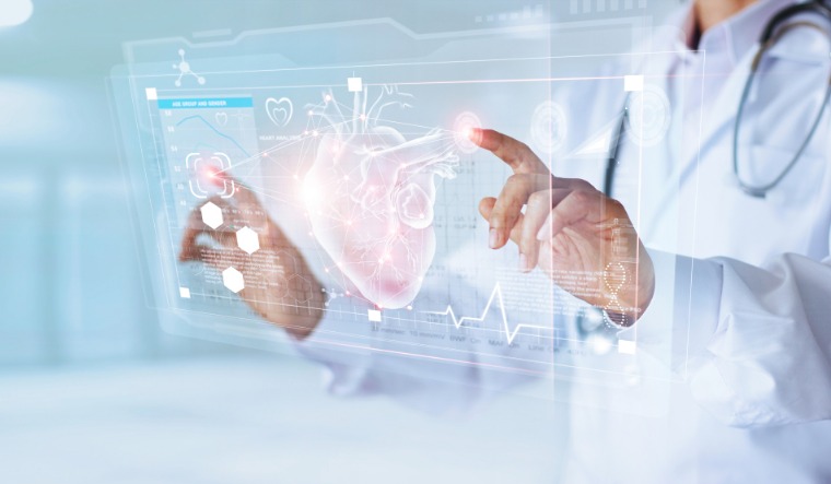 AI-model developed to predict irregular heartbeat 30 minutes before onset - Vimarsana News