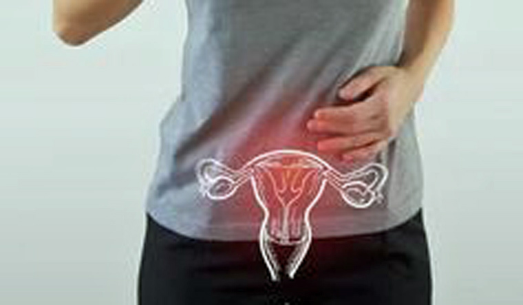Cervical cancer: What you need to know - Vimarsana News
