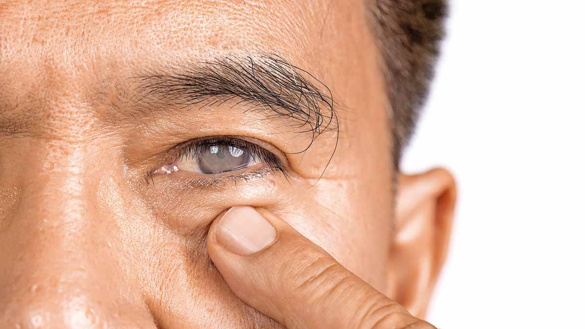 Why younger people are getting cataract: Causes, symptoms and treatment