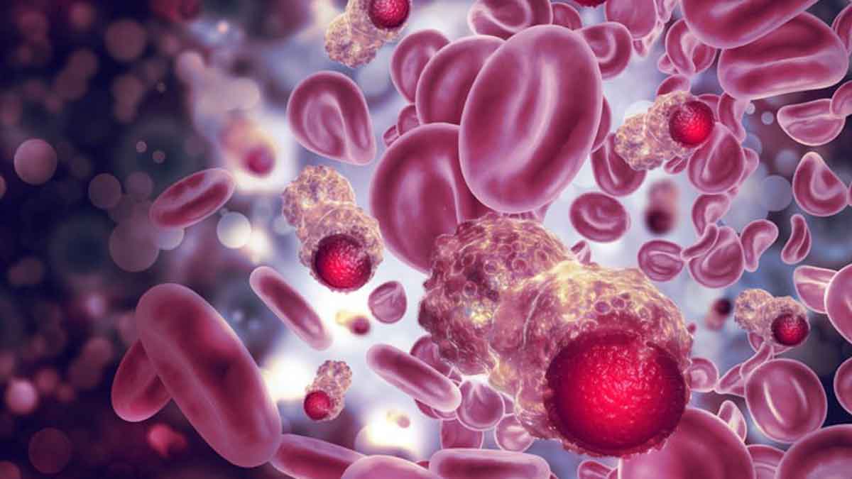 Scientists discover how cancer reprograms white blood cells to help it grow