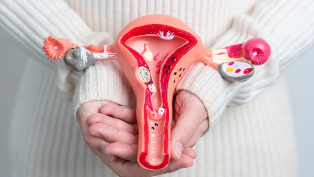 Uterine fibroids may raise heart disease risk by over 80 per cent: What every woman needs to know