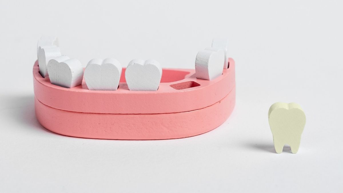 The silent impact of ageing dental work: Why 10-year-old fillings and crowns may be dangerous