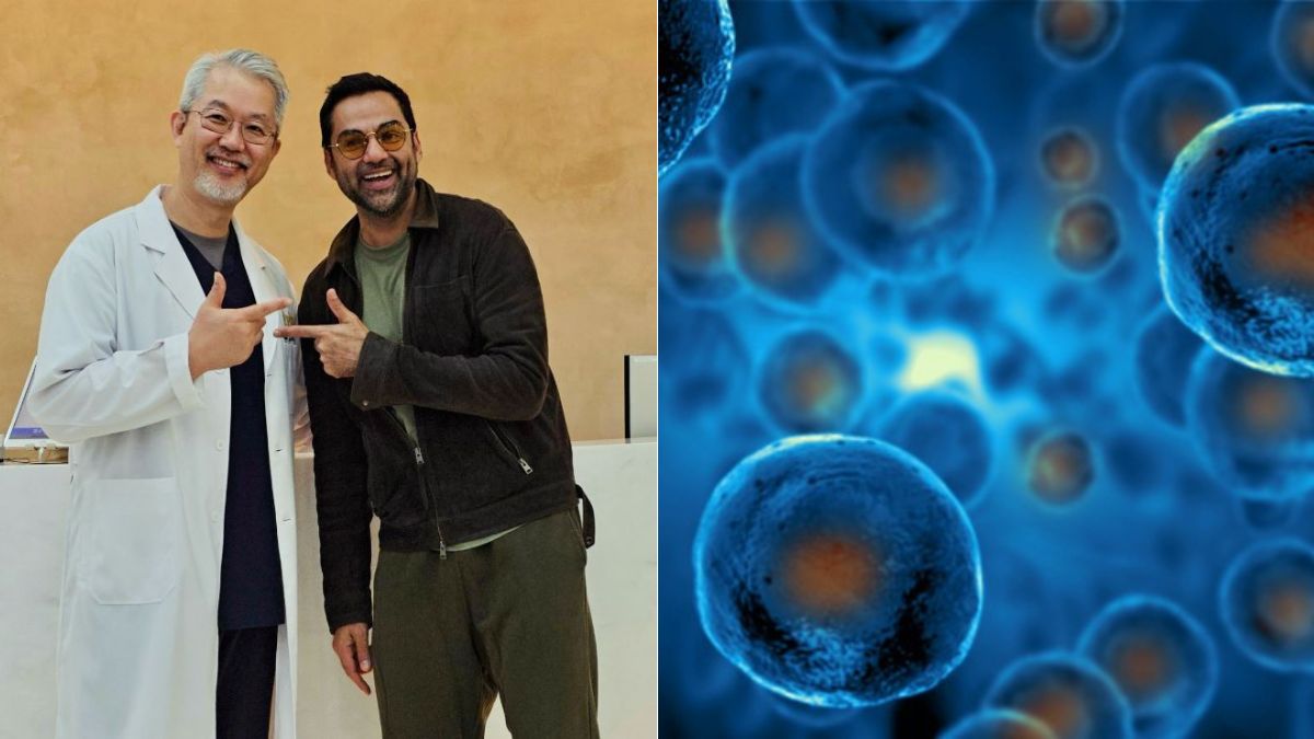 Abhay Deol tried stem cell therapy for sciatica — but does it really work?