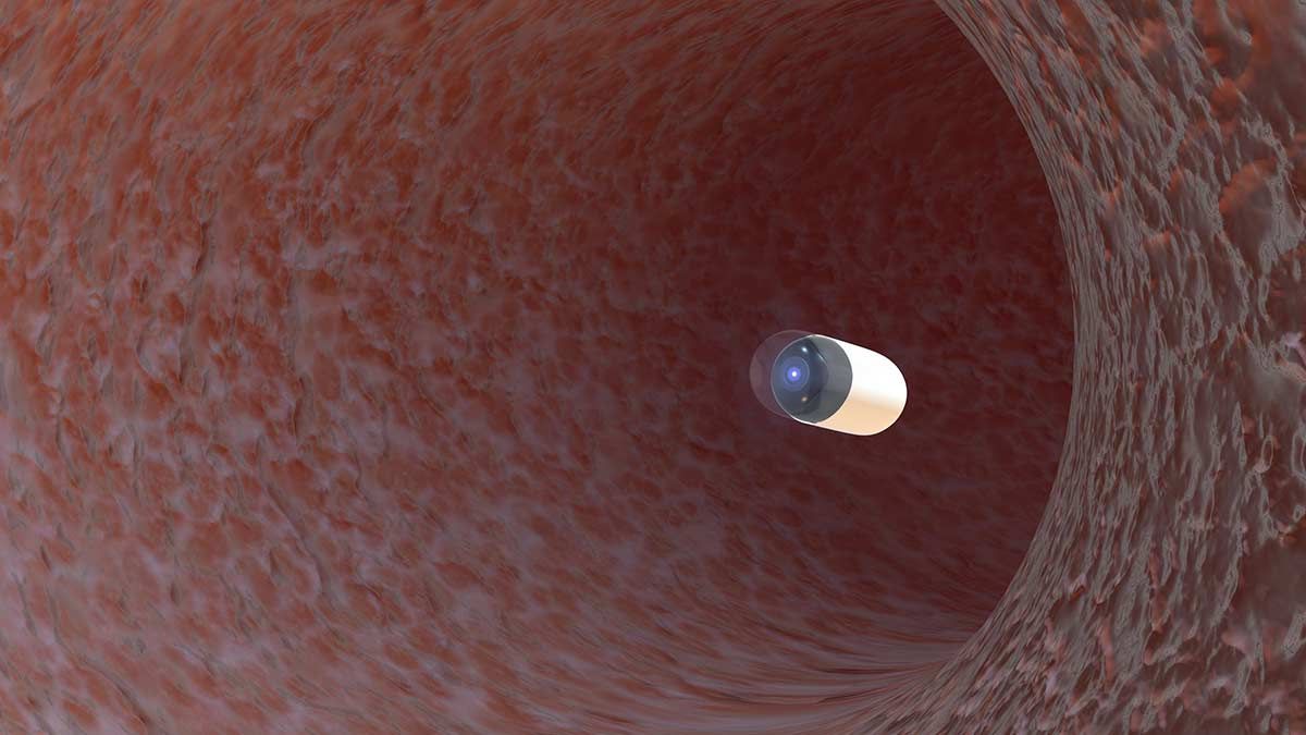 MIT scientists create a pill that sends a signal from inside your stomach
