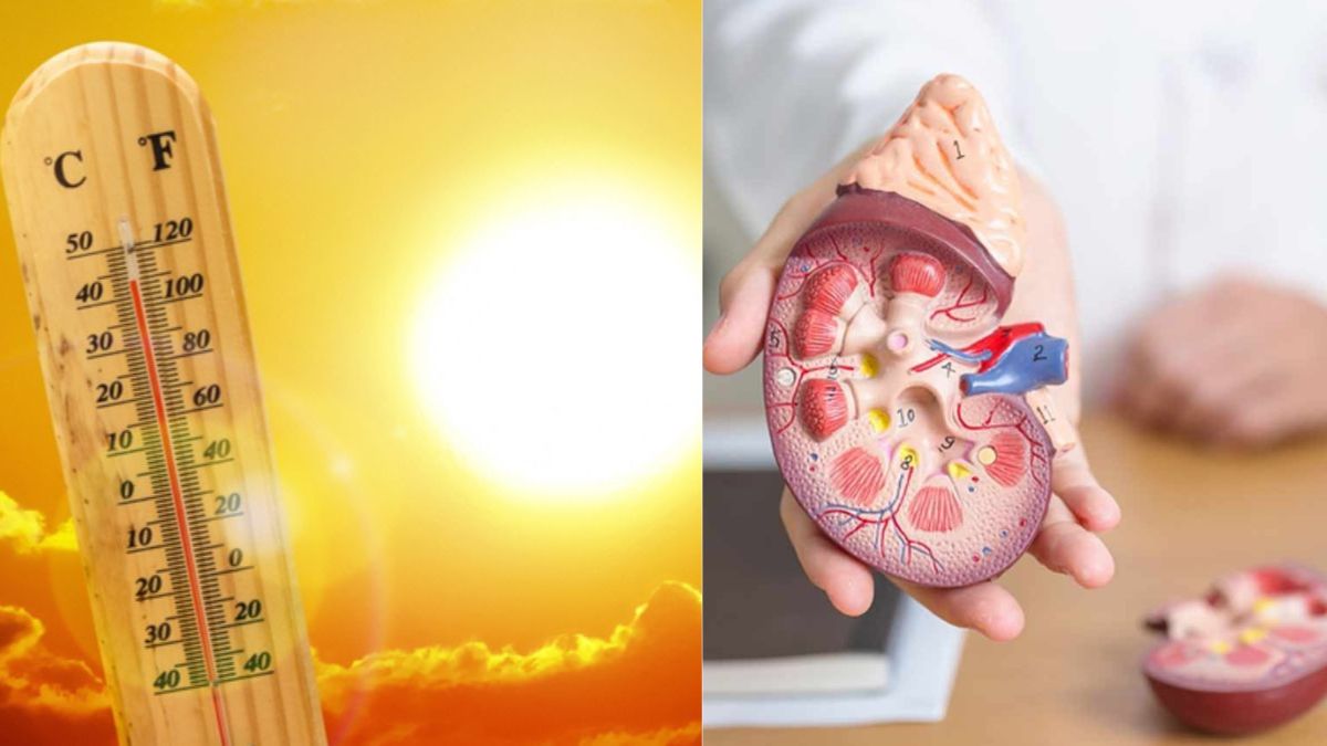 Heatwaves and kidney failure: Why summer is emerging as a renal health risk in India