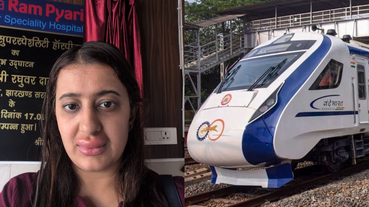 Vande Bharat food scare: Woman, toddler fall ill—What to do during an allergy reaction