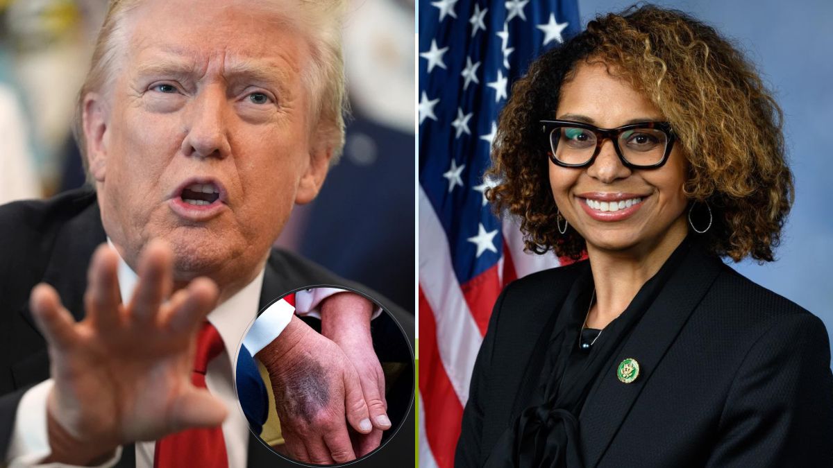 Is Donald Trump taking anti-Alzheimer's drug? Why US lawmaker is 'asking questions' about his health